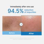[Subscr.] Zero Pore Blackhead Deep Cleansing Oil