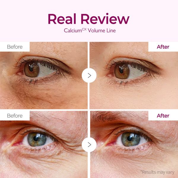 Calcium Bonding Eye Cream &amp; Eye Patch 60ea