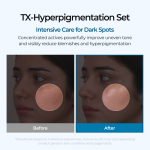 Dark Spot &amp; Uneven Tone Peel Shot TX Duo