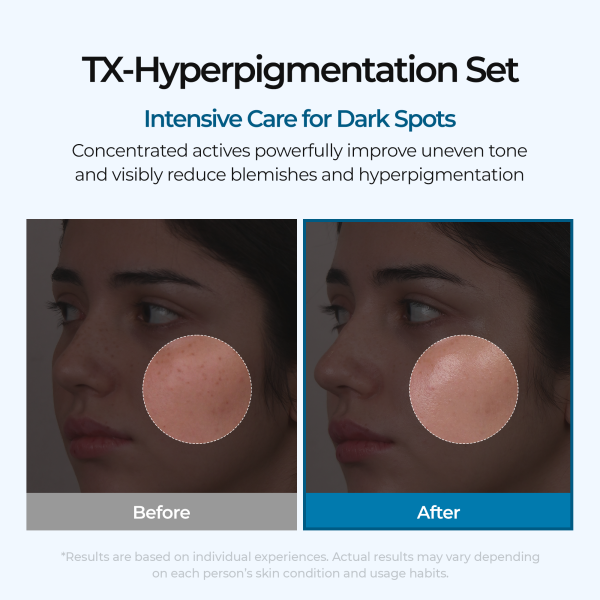 Dark Spot &amp; Uneven Tone Peel Shot TX Duo