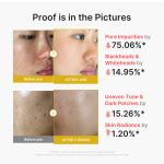 Kojic Acid Turmeric Peel Shot