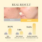 [Subscr.] Kojic Acid Turmeric Gold Jelly Gel Mask