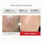 [Subscr.] Red Succinic Acid Panthenol Pads