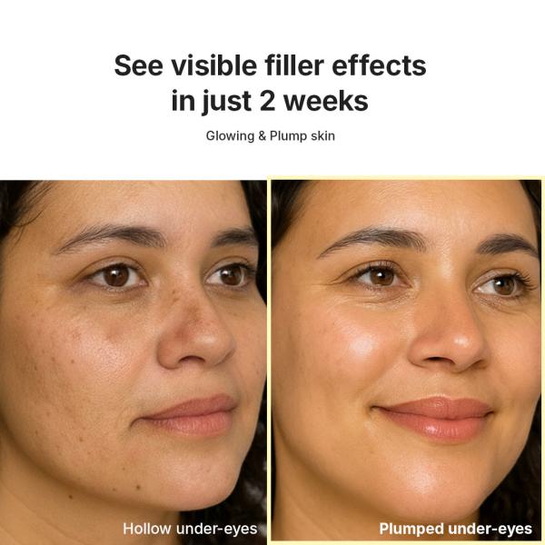 [Amazon Exclusive] Deep Collagen wrinkle filler Serum