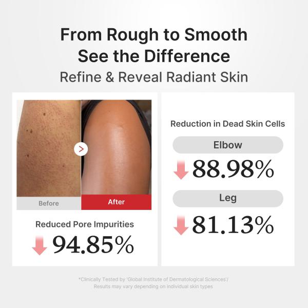 Hypochlorous Acid Rice Body Peel Shot