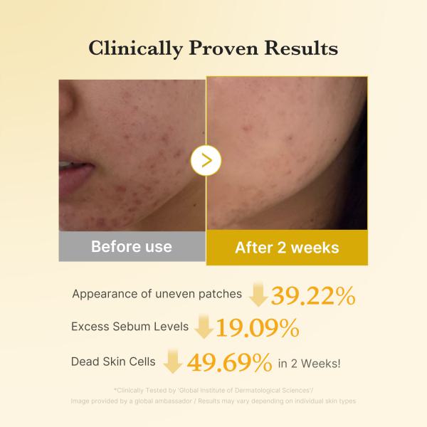 Kojic Acid Turmeric Toner Pad