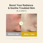 Kojic Acid Turmeric Vitamin Gold Jelly Mist Serum