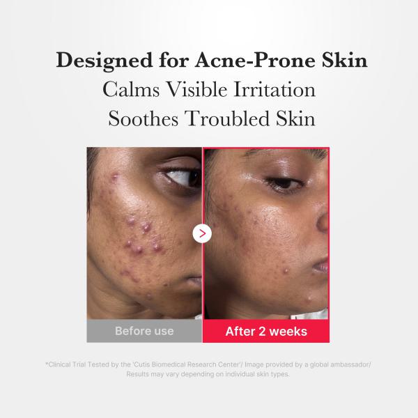 [Subscr.] Hypochlorous Acid Power Soothing Spray