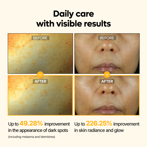 Kojic Acid Turmeric Serum