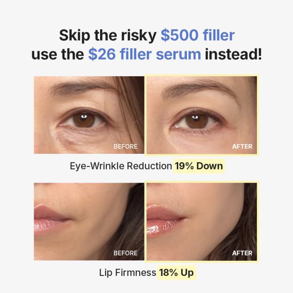 [Amazon Exclusive] Deep Collagen wrinkle filler Serum