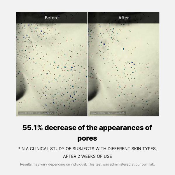 Pore Care Duo