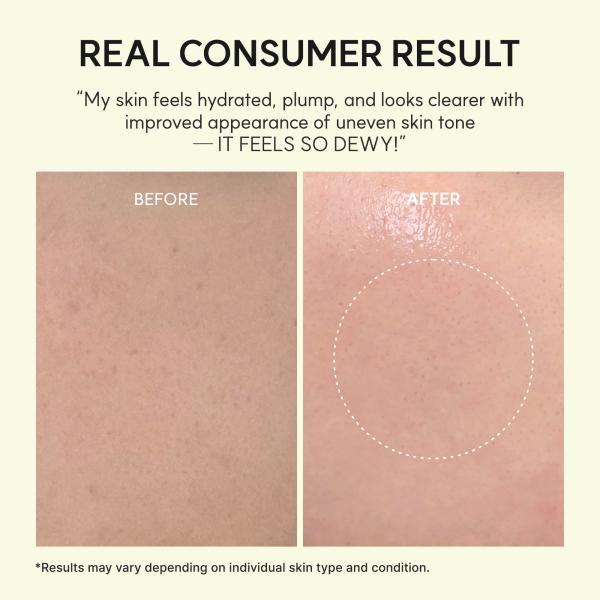 Vitamin C Glutathione Hydrogel Eye Patches for Dark Circles &amp; Puffy Eyes