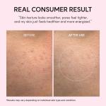 PDRN Booster Shot, Rosy-PDRN &amp; Peptides for Glowy, Healthy Skin - Recommended for Sensitive, Red Skin 1.01 fl oz