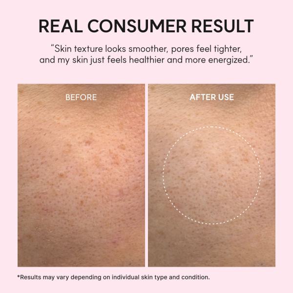 PDRN Booster Shot, Rosy-PDRN &amp; Peptides for Glowy, Healthy Skin - Recommended for Sensitive, Red Skin 1.01 fl oz