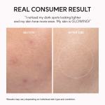 TXA Booster Shot, Intensive Dark Spot Correcting Serum with 5% TXA, Niacinamide &amp; 10 Peptides for Visible Tone Correction &amp; Radiant-Looking Skin, 1.01 fl. oz.