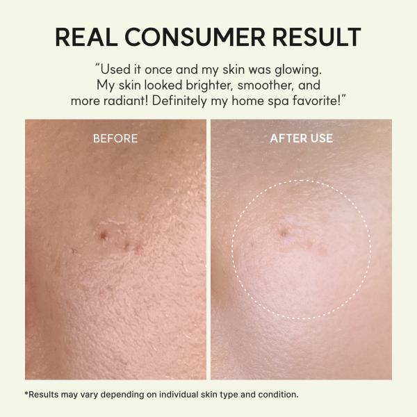 Vita Collagen Radiance Jello Mask, Cooling Gel Mask for Instant Glow &amp; Hydration with Vitamin C Complex, Glutathione &amp; Collagen, 4 Sheets