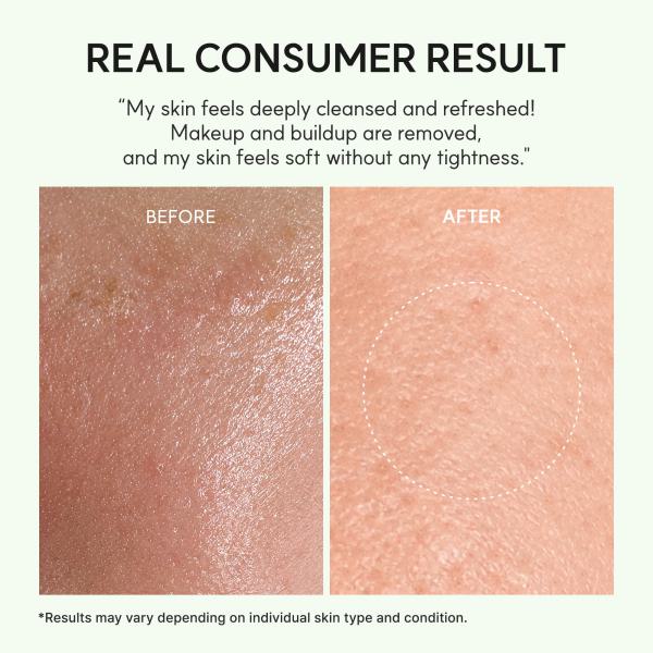 Pore Melt Mochi Makeup-Removing Cleansing Oil, Non-Comedogenic, Rice Amino Acids HD, Vitamin E, Cica, &amp; Ceramide, 6.76 fl oz