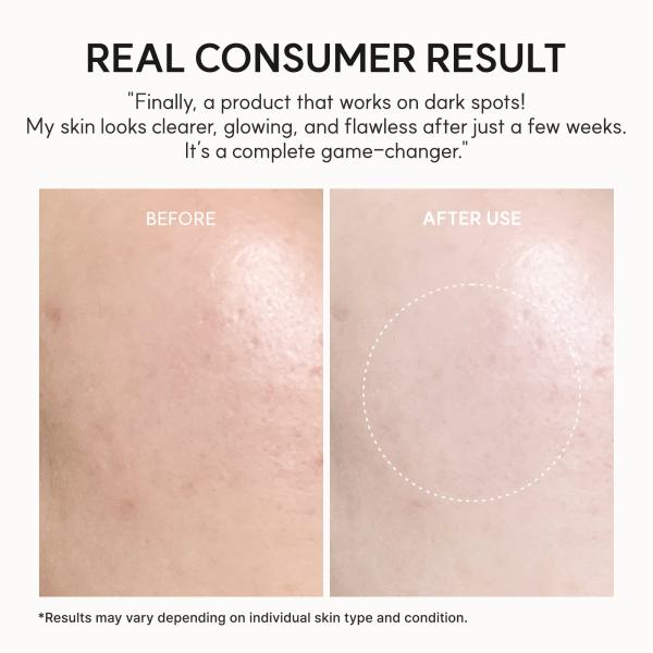 Vitamin C Glow Booster Gel Cream, Lightweight Brightening Gel Moisturizer for Even Tone &amp; Radiant Skin, 1.76 oz