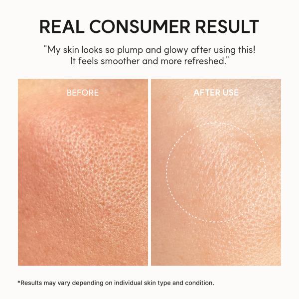 NAD+ Time-Rewind Booster Shot, Firming &amp; Revitalizing Serum with 5% NAD+ Complex, Peptides &amp; Resveratrol, 1.01 fl. oz.