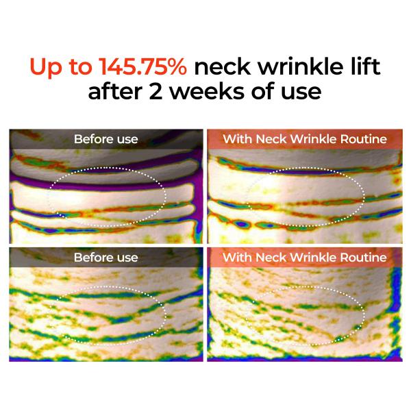 Calcium Boost Neck &amp; Eye Set