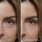 [Day&amp;Night Care] Eyephalt Eyebag Lifting Line