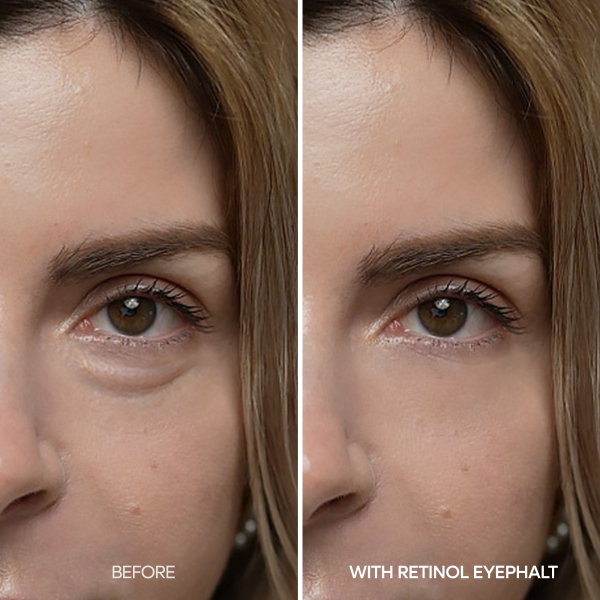 [Day&amp;Night Care] Eyephalt Eyebag Lifting Line