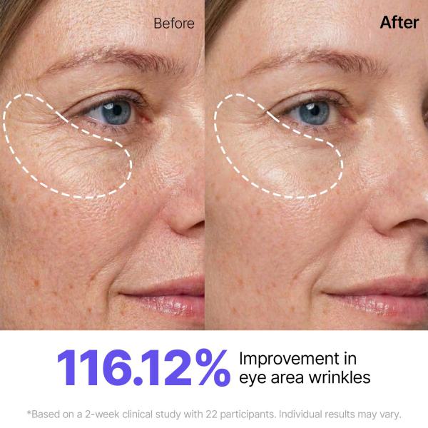 Silk Peptide Lifting Set