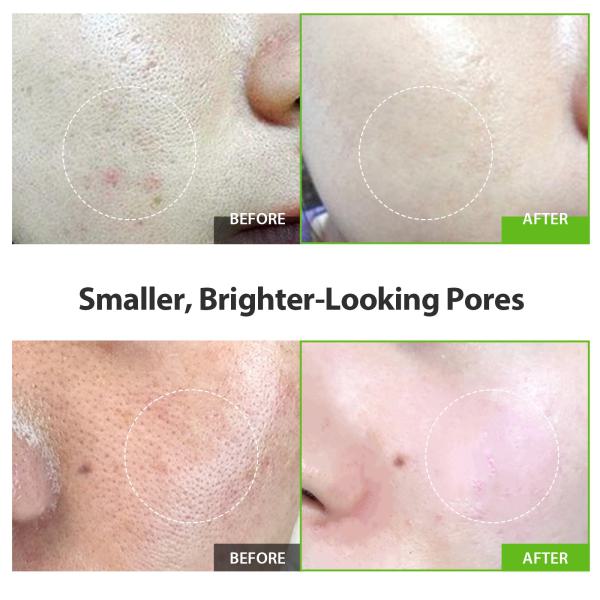 Green Tomato Pore Lifting Ampoule+