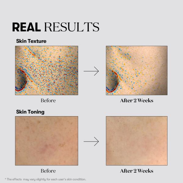 Tx-toning Toner