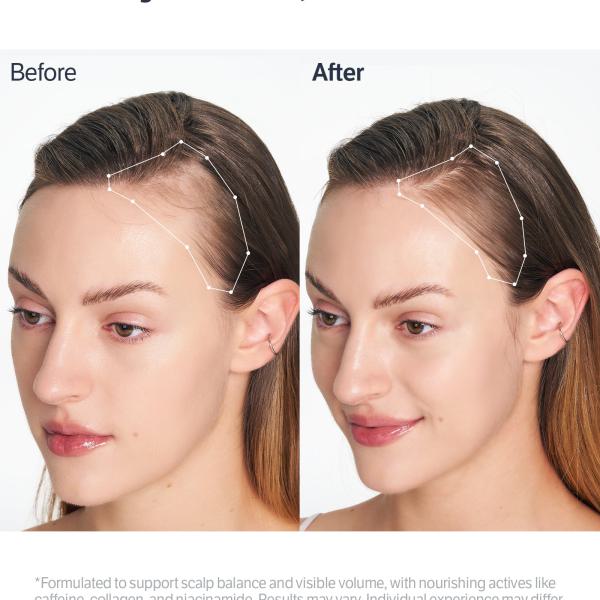 Deep Collagen Retinol Advanced Scalp Treatment Serum
