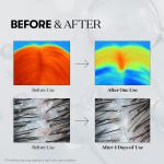 3-Month Hair Growth Set