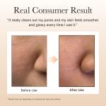 Calendula Rice Mochi Cleanser, Gentle Exfoliating Foam Wash for Sensitive, Dry, Rough Skin, 4.23oz / 120g