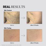 Tx-toning Daily Mask