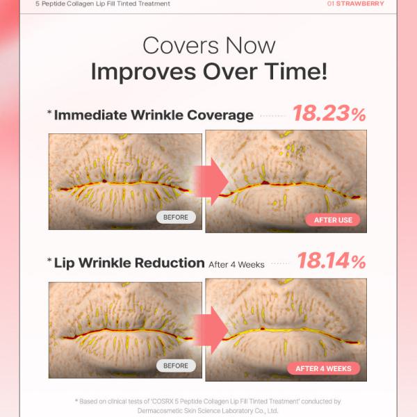 5 Peptide Collagen Tinted Lip Fill Treatment