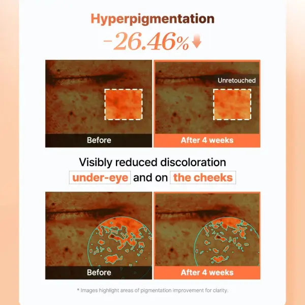 COSRX 5 PDRN Collagen Vitalizing Hydrogel Eye Patch