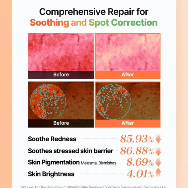 COSRX 5 PDRN B5 Vital Soothing Toner
