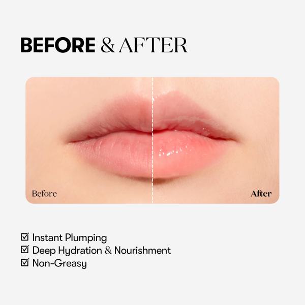 Reedle shot Lip Plumper_Beginner
