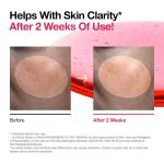 ANUA NIACINAMIDE 10%+TXA 4% Serum