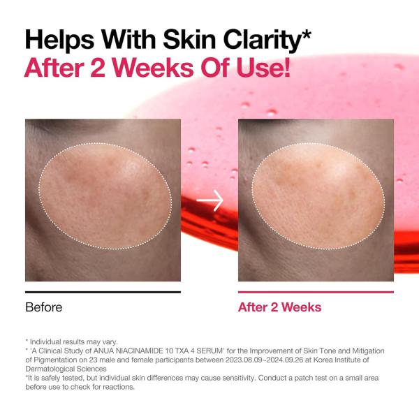 ANUA NIACINAMIDE 10%+TXA 4% Serum