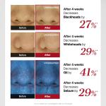 The AHA 2 BHA 2 Blemish Treatment Serum