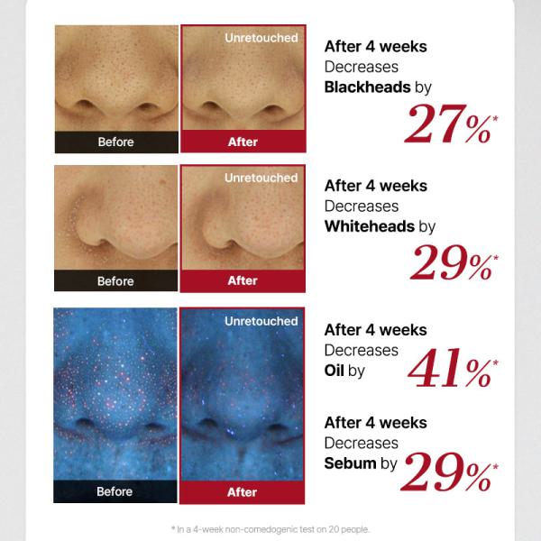 The AHA 2 BHA 2 Blemish Treatment Serum