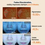 COSRX The Alpha-Arbutin Discoloration Care Hydrogel Mask