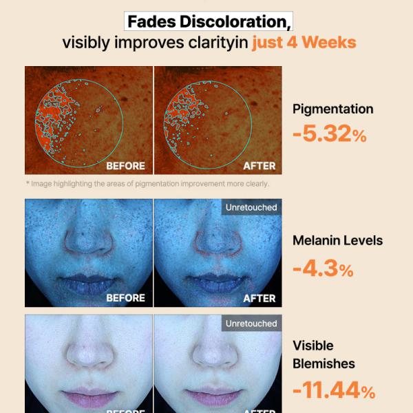 COSRX The Alpha-Arbutin Discoloration Care Hydrogel Mask