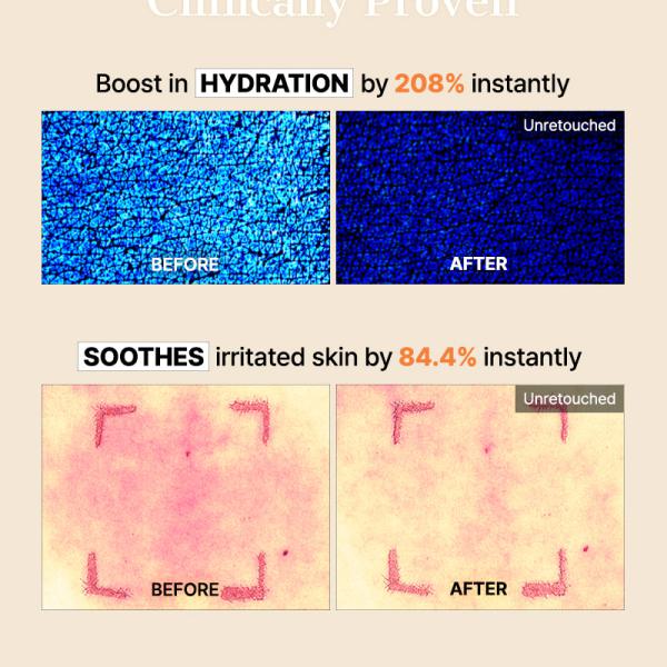 COSRX The Alpha-Arbutin Discoloration Care Hydrogel Mask