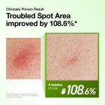 Azelaic Acid 10 Hyaluron Redness Soothing Serum