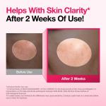 Niacinamide 10 TXA 4 Serum for Brightening and Dark Spots