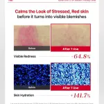 COSRX Azelaic Acid 10 B5 Redness Soothing Cream