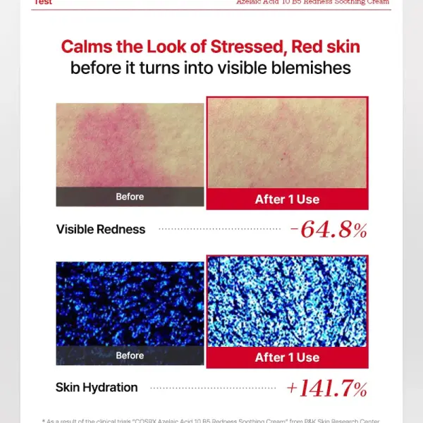 COSRX Azelaic Acid 10 B5 Redness Soothing Cream