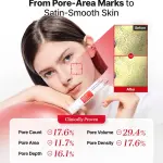 COSRX Azelaic Acid 10 B5 Redness Soothing Cream