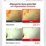 COSRX Azelaic Acid 10 B5 Redness Soothing Cream